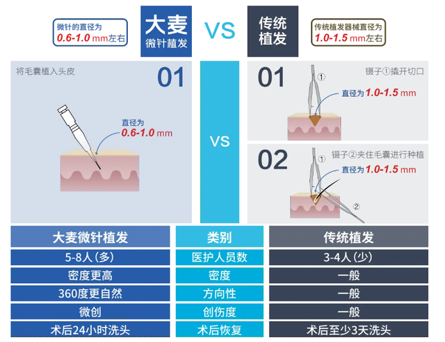 大麦植发独家揭秘，关于发际线种植的小秘密！