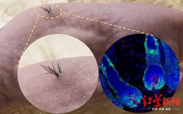 秃顶有救了 科学家找到培育无限量头发方法