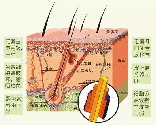 什么是毛发移植技术？来听听普陀专家怎么说→