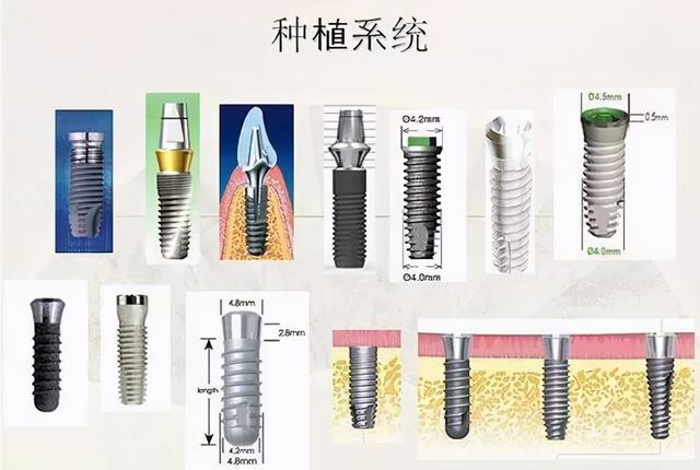 为什么种植系统选择瑞士或者瑞典的植体？其他国家的植体不好吗？